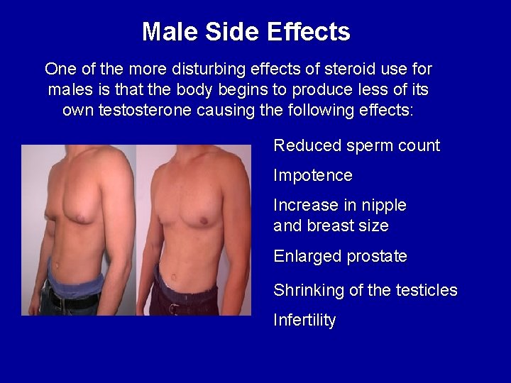 Male Side Effects One of the more disturbing effects of steroid use for males