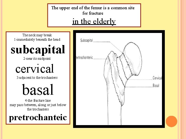 The upper end of the femur is a common site for fracture in the