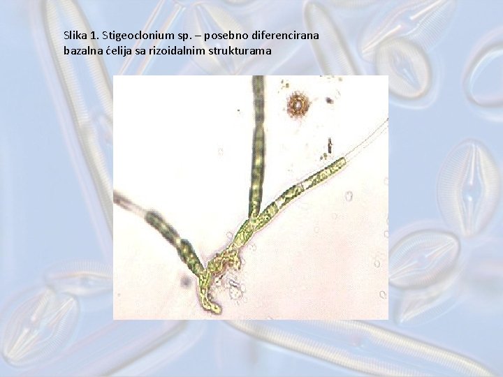 Slika 1. Stigeoclonium sp. – posebno diferencirana bazalna ćelija sa rizoidalnim strukturama 