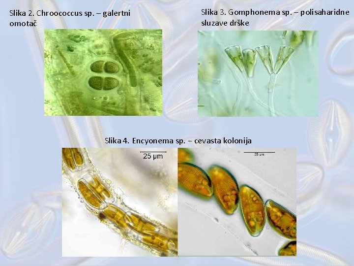 Slika 2. Chroococcus sp. – galertni omotač Slika 3. Gomphonema sp. – polisaharidne sluzave