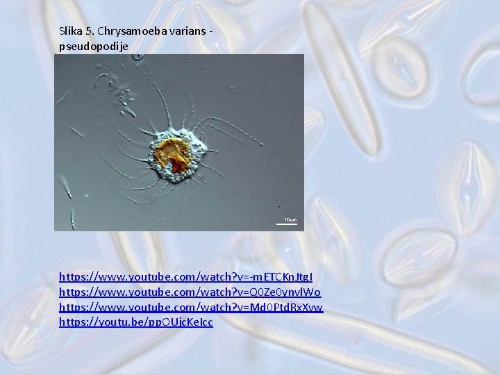 Slika 5. Chrysamoeba varians pseudopodije https: //www. youtube. com/watch? v=-m. ETCKn. Jtg. I https: