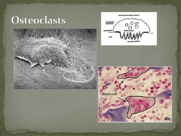 Osteoclasts  Osteoclasts