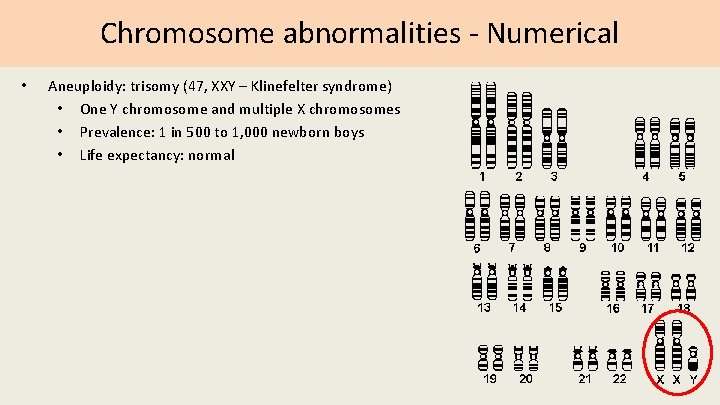 Chromosome abnormalities - Numerical • Aneuploidy: trisomy (47, XXY – Klinefelter syndrome) • One