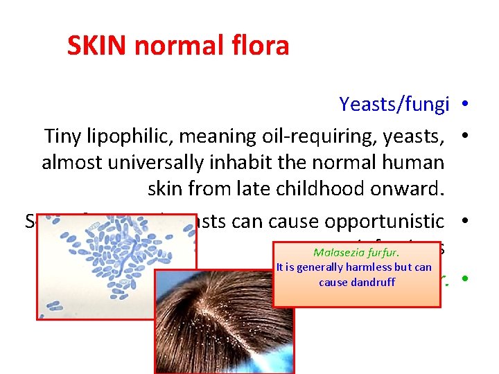 SKIN normal flora Yeasts/fungi Tiny lipophilic, meaning oil-requiring, yeasts, almost universally inhabit the normal