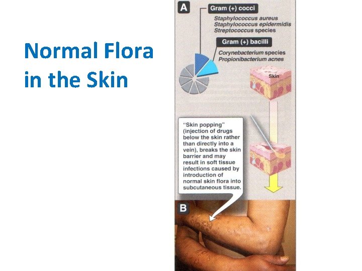 Normal Flora in the Skin 