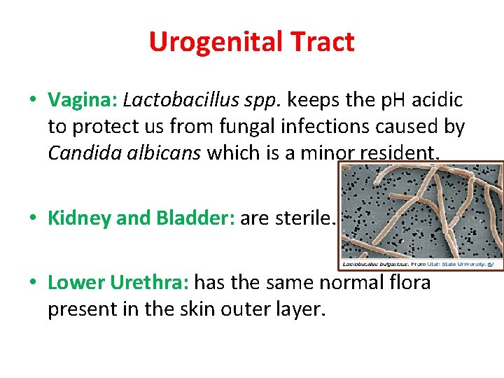 Urogenital Tract • Vagina: Lactobacillus spp. keeps the p. H acidic to protect us