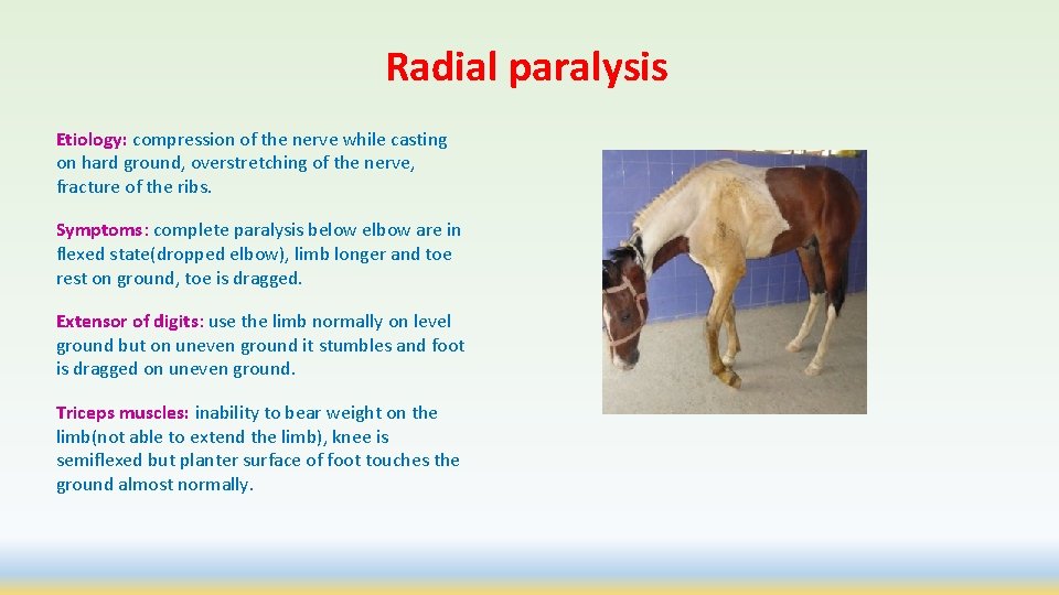 Radial paralysis Etiology: compression of the nerve while casting on hard ground, overstretching of