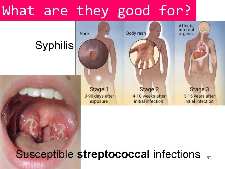 What are they good for? Syphilis Susceptible streptococcal infections 32 