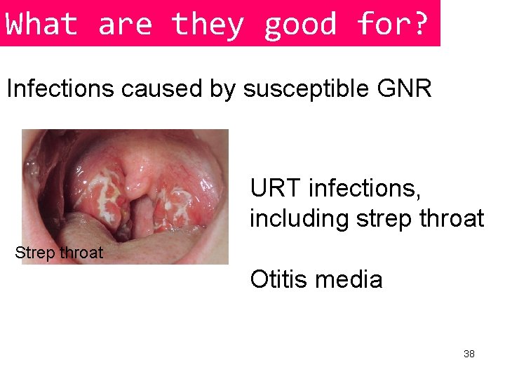 What are they good for? Infections caused by susceptible GNR URT infections, including strep
