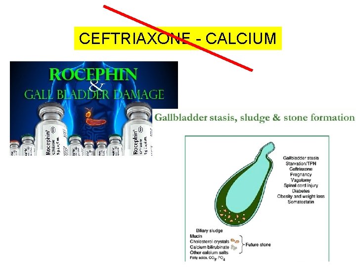 CEFTRIAXONE - CALCIUM 63 