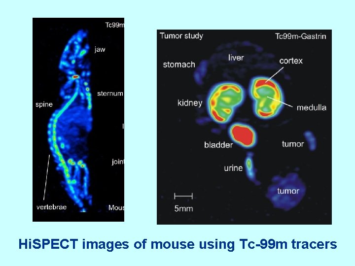Hi. SPECT images of mouse using Tc-99 m tracers 