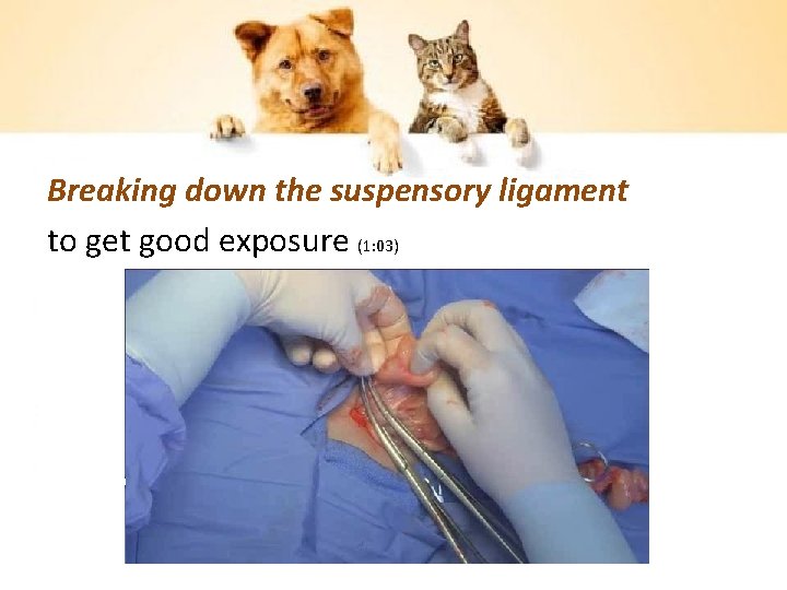 Breaking down the suspensory ligament to get good exposure (1: 03) 