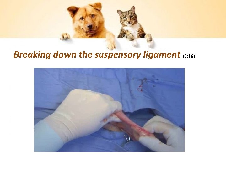 Breaking down the suspensory ligament (0: 16) 