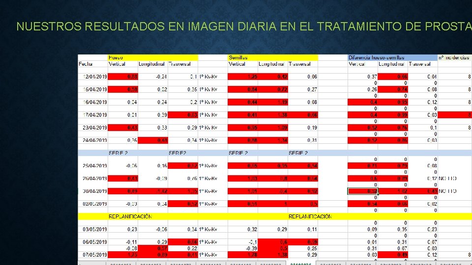 NUESTROS RESULTADOS EN IMAGEN DIARIA EN EL TRATAMIENTO DE PROSTA 