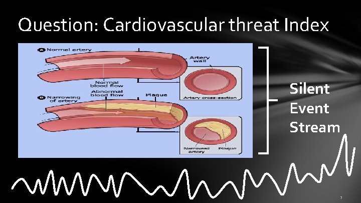 Question: Cardiovascular threat Index Silent Event Stream 7 