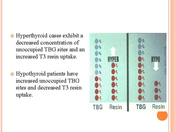 Hyperthyroid cases exhibit a decreased concentration of unoccupied TBG sites and an increased T