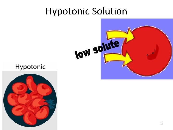 Hypotonic Solution 33 