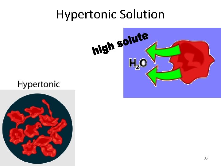 Hypertonic Solution 36 