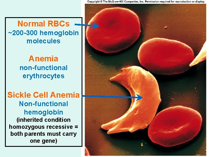 Normal RBCs ~200 -300 hemoglobin molecules Anemia non-functional erythrocytes Sickle Cell Anemia Non-functional hemoglobin