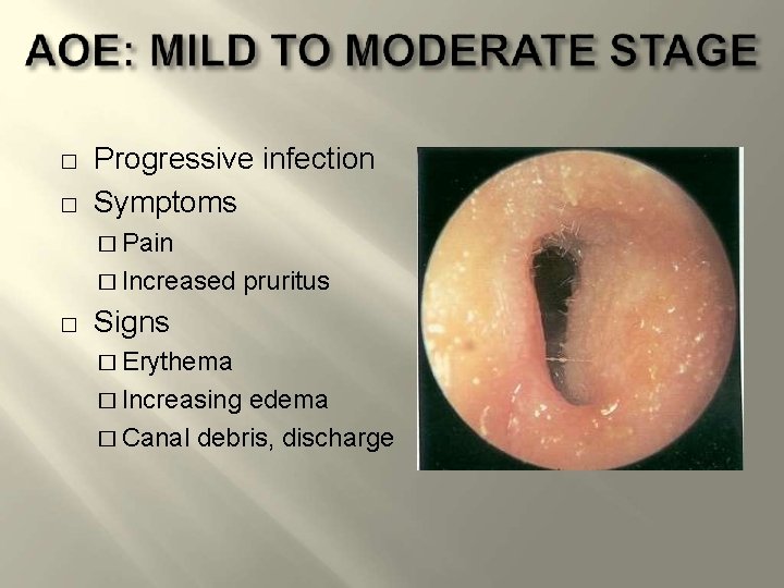 � � Progressive infection Symptoms � Pain � Increased � pruritus Signs � Erythema