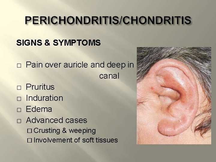 SIGNS & SYMPTOMS � � � Pain over auricle and deep in canal Pruritus