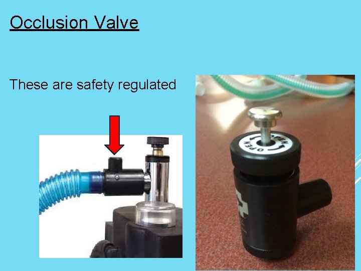 Occlusion Valve These are safety regulated 
