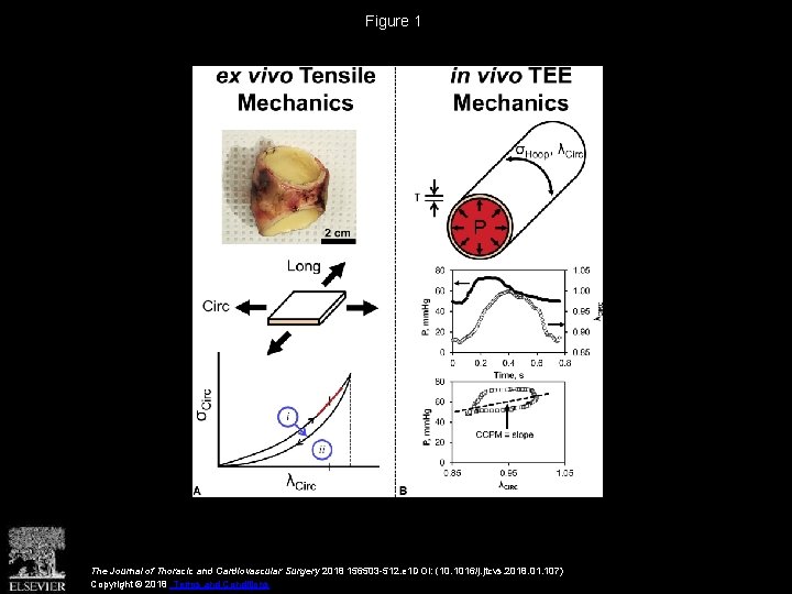 Figure 1 The Journal of Thoracic and Cardiovascular Surgery 2018 156503 -512. e 1