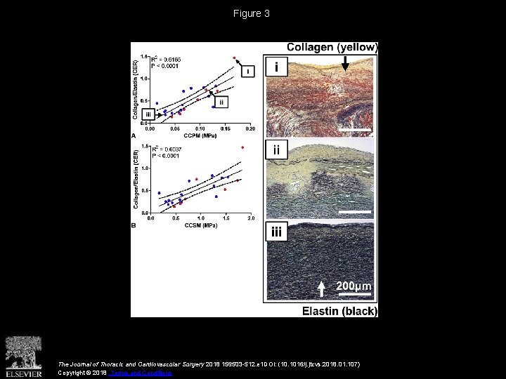 Figure 3 The Journal of Thoracic and Cardiovascular Surgery 2018 156503 -512. e 1