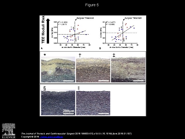 Figure 5 The Journal of Thoracic and Cardiovascular Surgery 2018 156503 -512. e 1