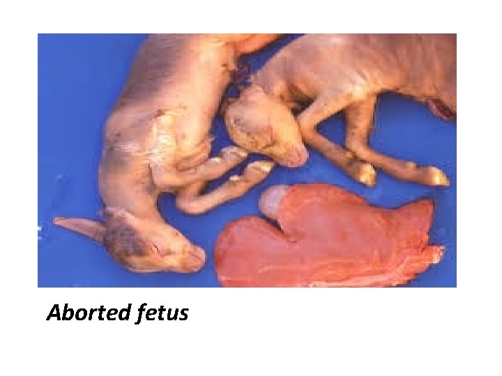 Aborted fetus 