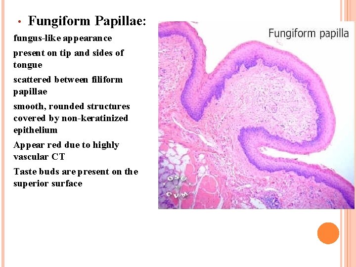  • Fungiform Papillae: fungus-like appearance present on tip and sides of tongue scattered