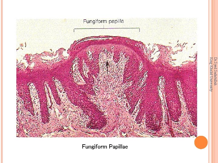 Dr. Syed Sadatullah King Khalid University Fungiform Papillae 