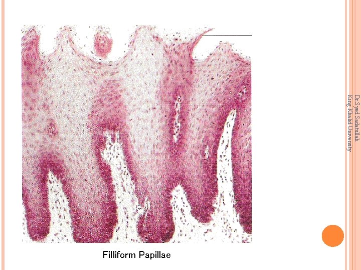 Dr. Syed Sadatullah King Khalid University Filliform Papillae 