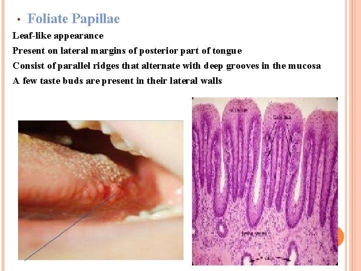  • Foliate Papillae Leaf-like appearance Present on lateral margins of posterior part of