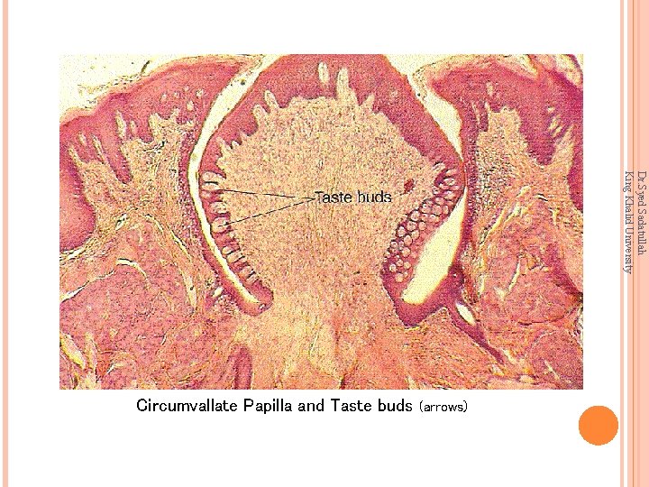 Dr. Syed Sadatullah King Khalid University Circumvallate Papilla and Taste buds (arrows) 