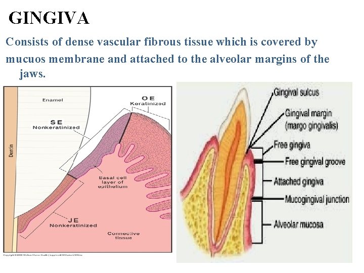 GINGIVA Consists of dense vascular fibrous tissue which is covered by mucuos membrane and
