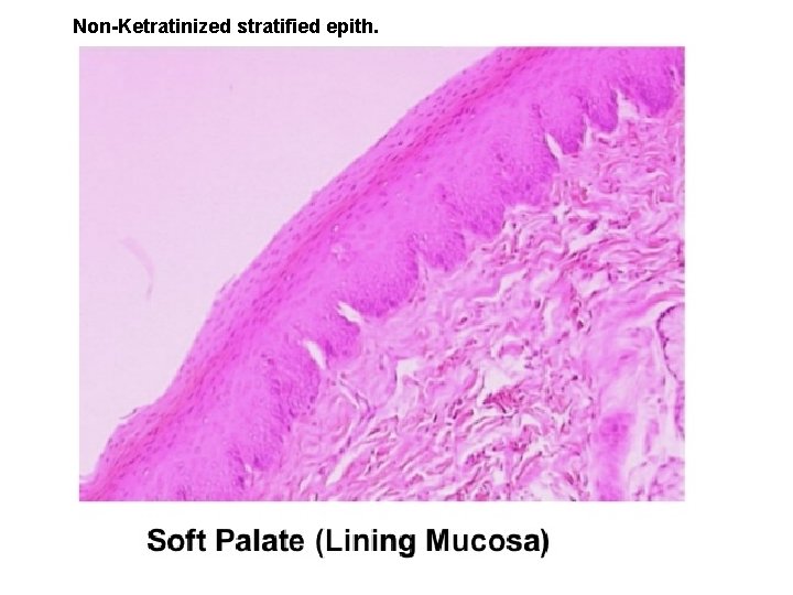 Non-Ketratinized stratified epith. 