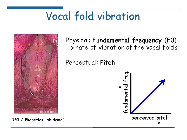 Vocal fold vibration Physical: Fundamental frequency (F 0) rate of vibration of the vocal