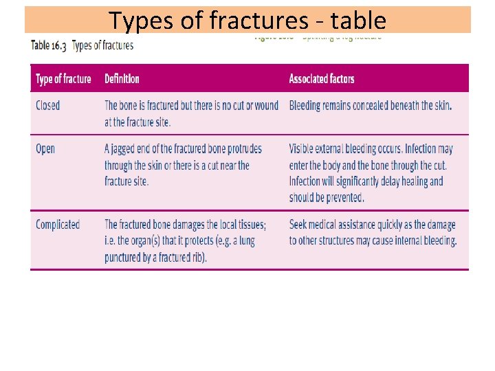 Types of fractures - table SS 