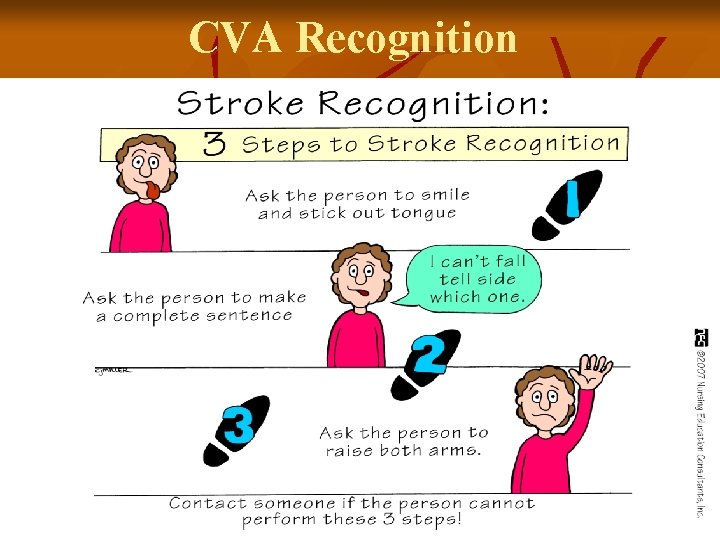 CVA Recognition 