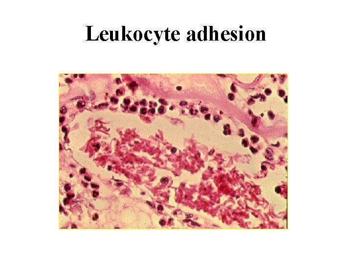 Leukocyte adhesion 