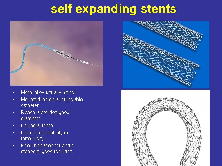 self expanding stents • • • Metal alloy usually nitinol Mounted inside a retrievable
