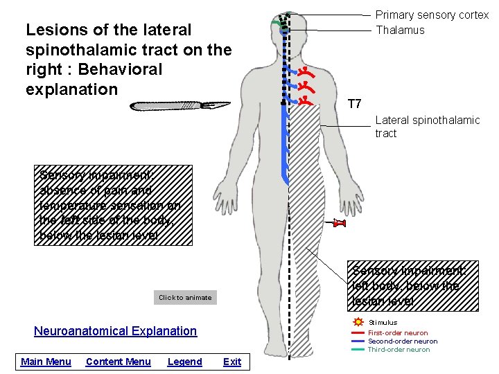 Lesions of the lateral spinothalamic tract on the right : Behavioral explanation Primary sensory