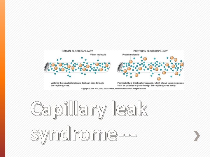 Capillary leak syndrome--- 