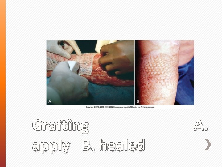 Grafting apply B. healed A. 