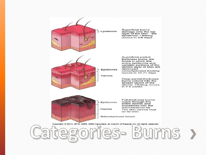 Categories- Burns 