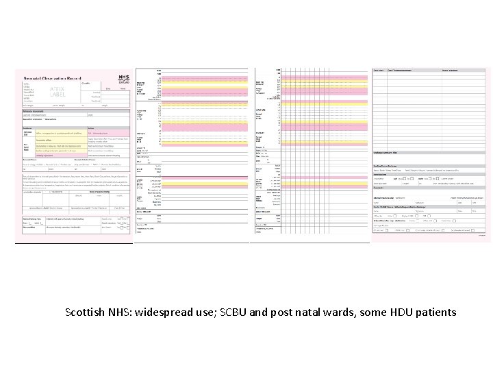 Scottish NHS: widespread use; SCBU and post natal wards, some HDU patients 