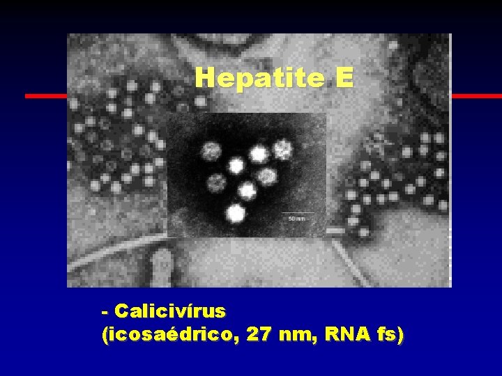 Hepatite E - Calicivírus (icosaédrico, 27 nm, RNA fs) 