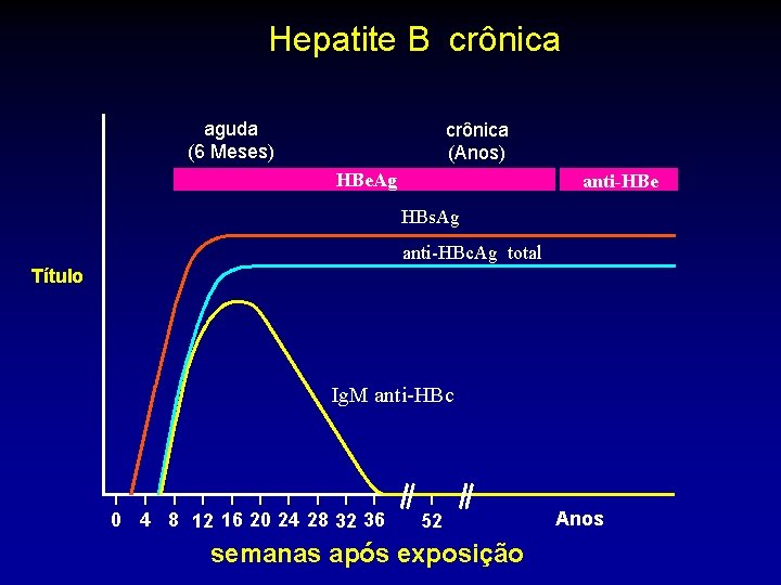 Hepatite B crônica aguda (6 Meses) crônica (Anos) HBe. Ag anti-HBe HBs. Ag anti-HBc.