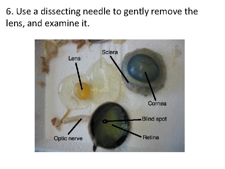 6. Use a dissecting needle to gently remove the lens, and examine it. 